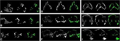 CT Segmentation of Dinosaur Fossils by Deep Learning